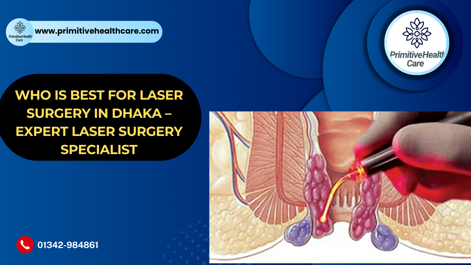 Who is Best for Laser Surgery in Dhaka – Expert Laser Surgery Specialist