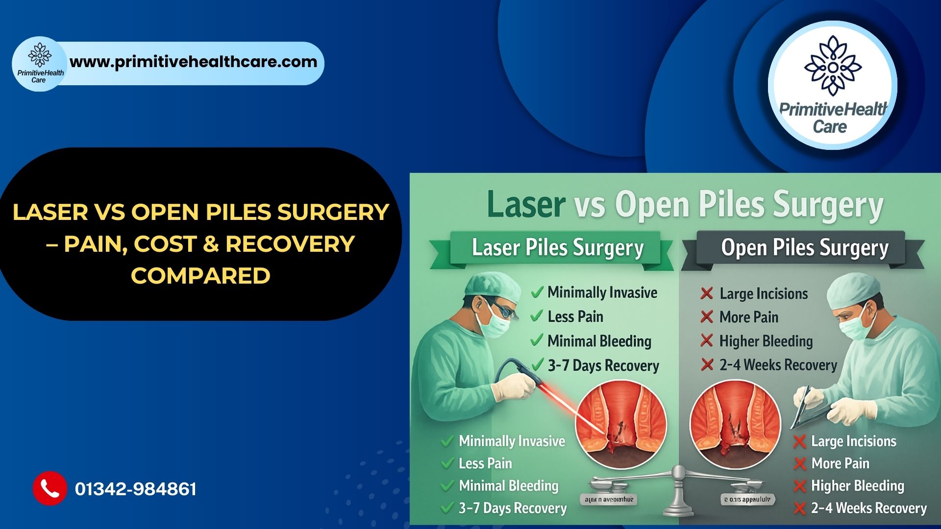 Laser vs Open Piles Surgery – Pain, Cost, Recovery & Results